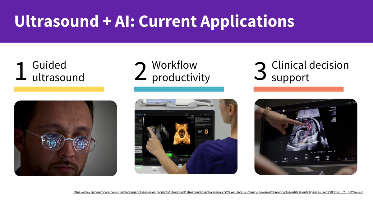 AI in ultrasound insights graphic (1).png