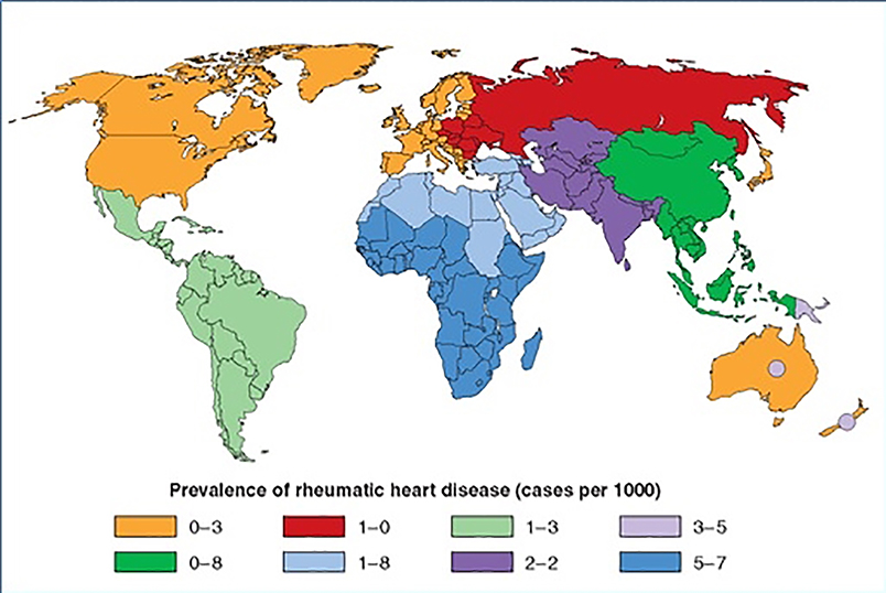 145_Pressman_Figure 2-Aetiology and epidemiology of mitral stenosis.jpg