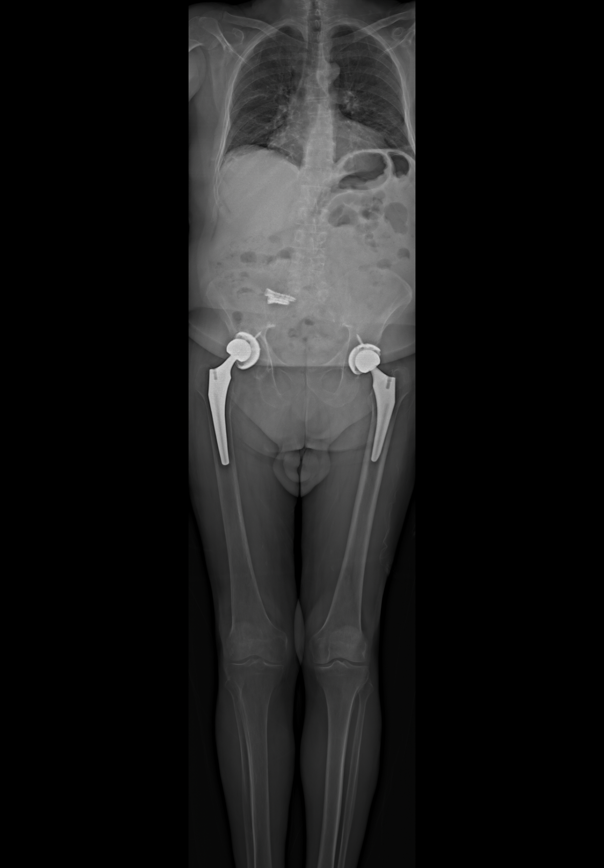 Patient image of: James Preston