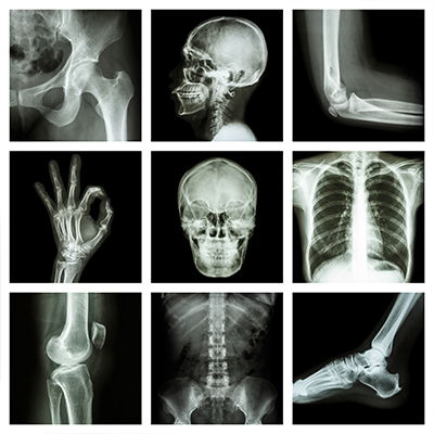 xray