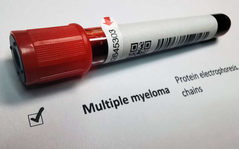 A vial of blood identified as from a Multiple Myeloma patient