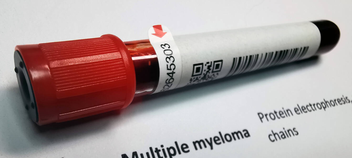 A vial of blood identified as from a Multiple Myeloma patient