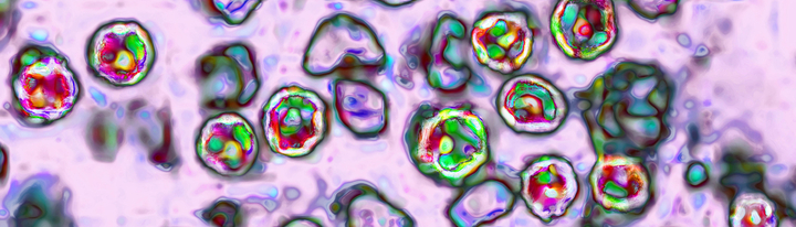Cells under a microscope.