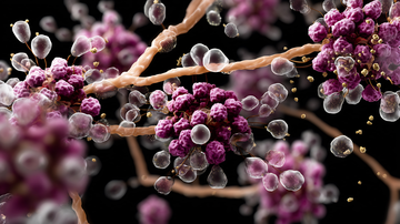 AdobeStock_1660620148_Amyloidosis protein buildup visualization.